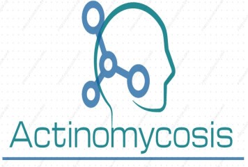 Actinomycosis